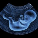 Abortion Laws in California